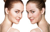 Makeup Tips and Guidelines For Acne-Prone Skin